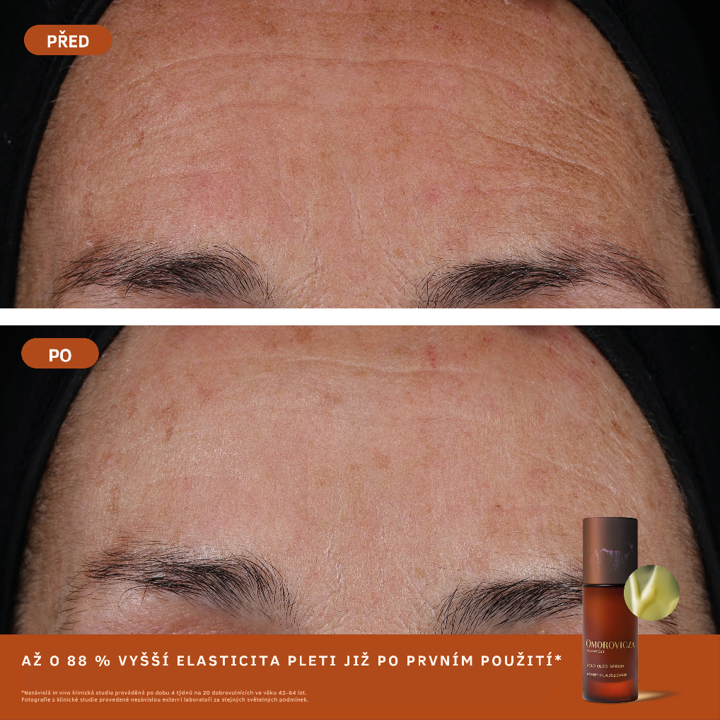 Omorovicza Gold Oleo Serum – produktová fotografie 1