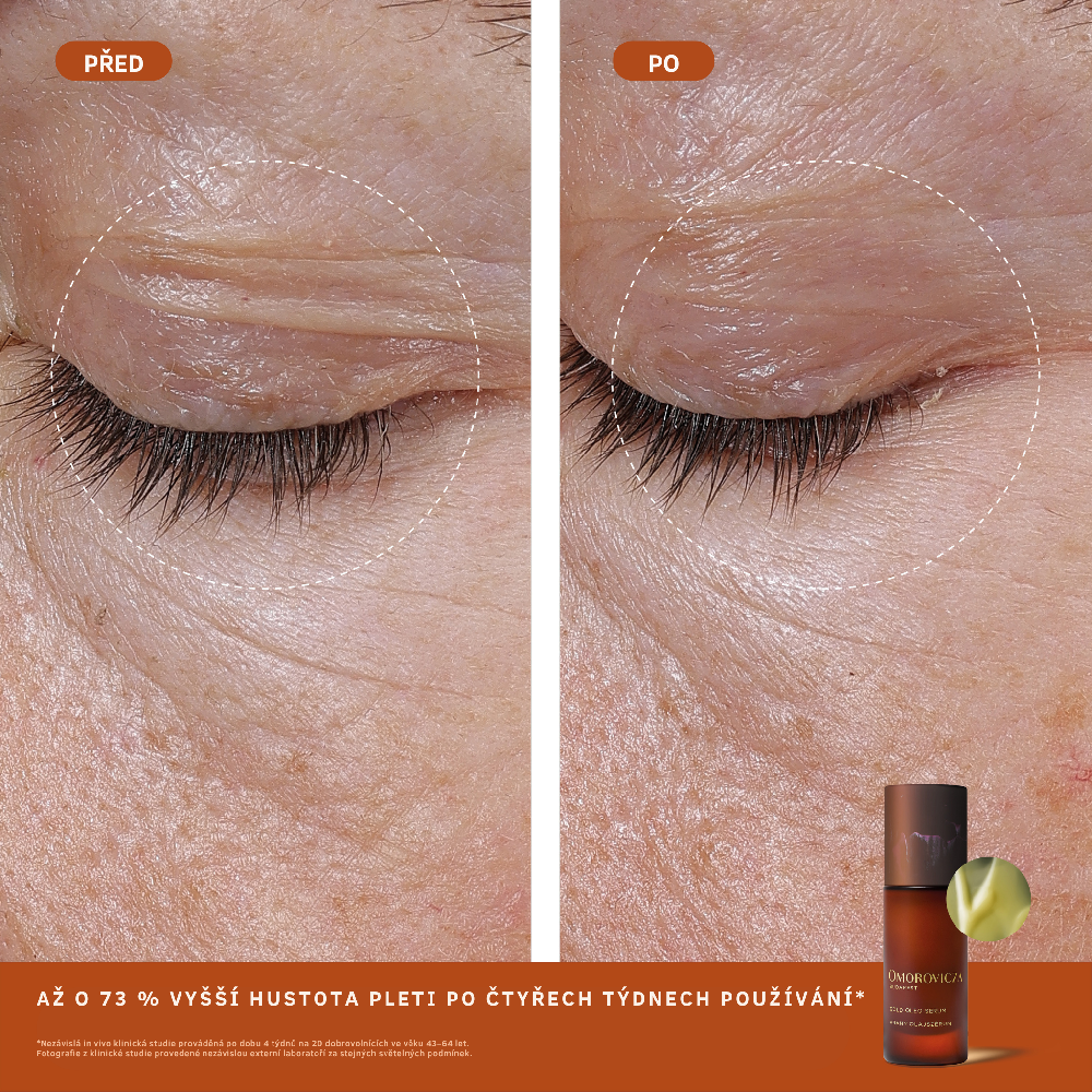 Omorovicza Gold Oleo Serum – produktová fotografie 2